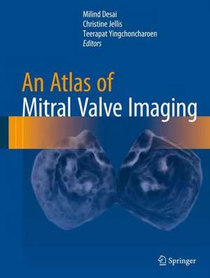 An Atlas of Mitral Valve Imaging de Milind Desai