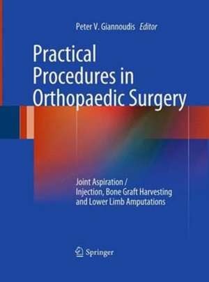 Practical Procedures in Orthopaedic Surgery: Joint Aspiration/Injection, Bone Graft Harvesting and Lower Limb Amputations de Peter V. Giannoudis