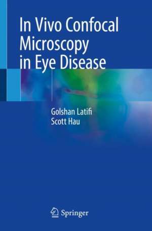 In Vivo Confocal Microscopy in Eye Disease de Golshan Latifi