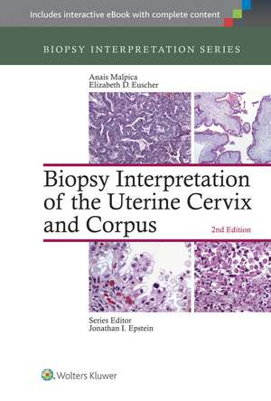 Biopsy Interpretation of the Uterine Cervix and Corpus de Anais Malpica MD