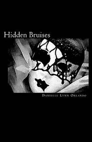 Hidden Bruises: True Stories of Redemption and Hope de Danielle Lynn Orlando