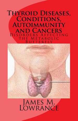 Thyroid Diseases, Conditions, Autoimmunity and Cancers de James M. Lowrance