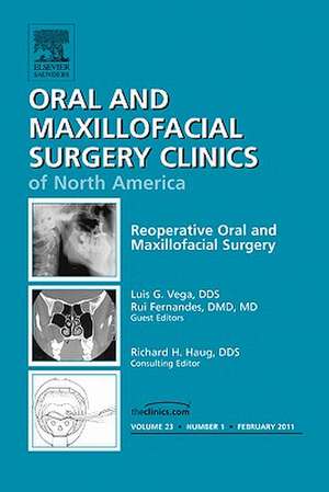 Reoperative Oral and Maxillofacial Surgery, An Issue of Oral and Maxillofacial Surgery Clinics de Rui Fernandes