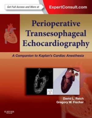 Perioperative Transesophageal Echocardiography: A Companion to Kaplan's Cardiac Anesthesia (Expert Consult: Online and Print) de David L. Reich