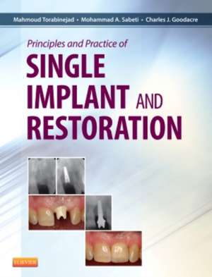 Principles and Practice of Single Implant and Restoration de Mahmoud Torabinejad