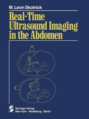 Real-time Ultrasound Imaging in the Abdomen de M.L. Skolnick