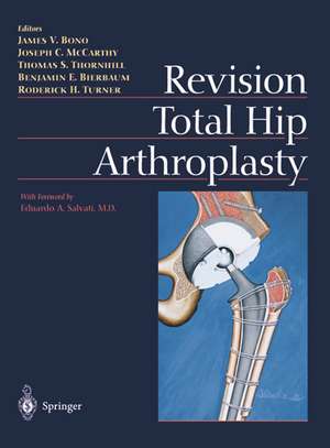 Revision Total Hip Arthroplasty de James V. Bono