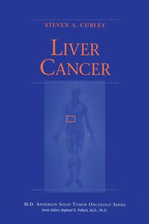 Liver Cancer de Steven A. Curley