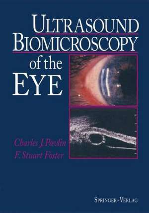 Ultrasound Biomicroscopy of the Eye de Charles J. Pavlin