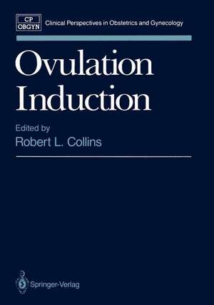 Ovulation Induction de Robert L. Collins