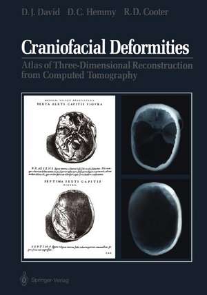 Craniofacial Deformities: Atlas of Three-Dimensional Reconstruction from Computed Tomography de David J. David