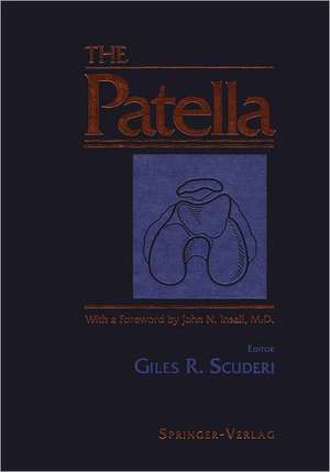 The Patella de Giles R. Scuderi