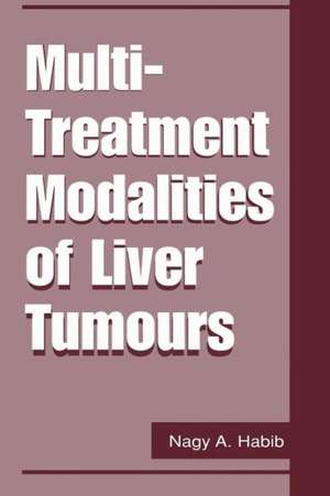 Multi-Treatment Modalities of Liver Tumours de Nagy A. Habib