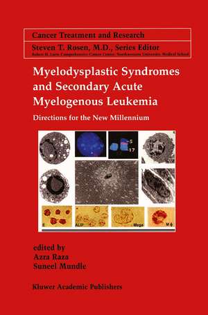 Myelodysplastic Syndromes & Secondary Acute Myelogenous Leukemia: Directions for the New Millennium de Azra Raza