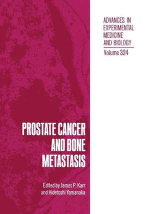 Prostate Cancer and Bone Metastasis de James P. Karr