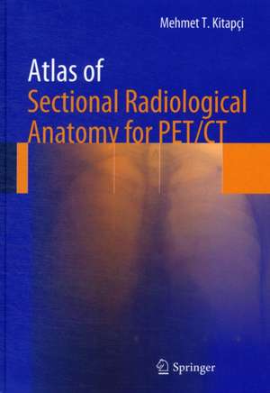 Atlas of Sectional Radiological Anatomy for PET/CT de Mehmet T. Kitapci