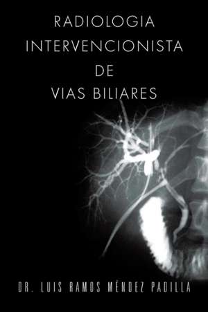 Radiologia Intervencionista de Vias Biliares de Luis Ramos Mendez Padilla