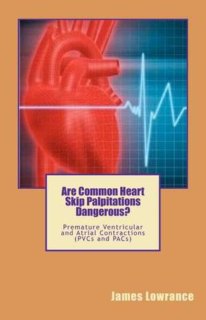 Are Common Heart Skip Palpitations Dangerous? de James M. Lowrance