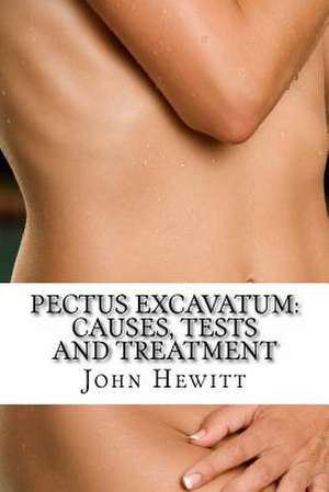 Pectus Excavatum de John Hewitt Ma