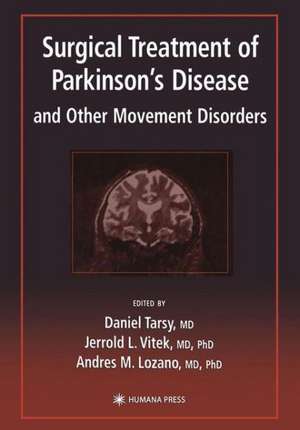 Surgical Treatment of Parkinson’s Disease and Other Movement Disorders de Daniel Tarsy