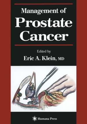 Management of Prostate Cancer de Eric A. Klein