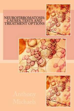 Neurofibromatosis de Anthony S. Michaels Ma