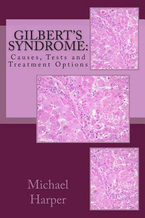Gilbert's Syndrome de Michael J. Harper Ma