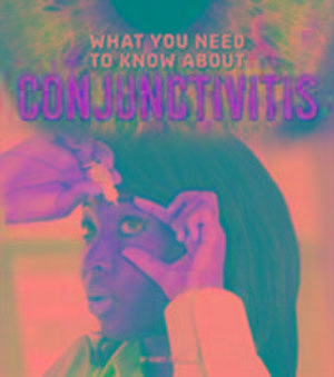 Dickmann, N: What You Need to Know about Conjunctivitis de Nancy Dickmann