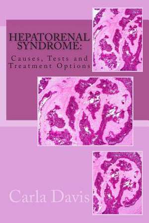 Hepatorenal Syndrome de Carla Davis Ma