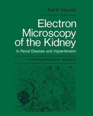 Electron Microscopy of the Kidney: In Renal Disease and Hypertension: A Clinicopathological Approach de Anil K. Mandal