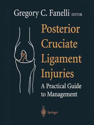 Posterior Cruciate Ligament Injuries: A Practical Guide to Management de J. Herring