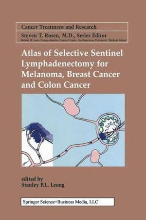 Atlas of Selective Sentinel Lymphadenectomy for Melanoma, Breast Cancer and Colon Cancer de Stanley P. L. Leong