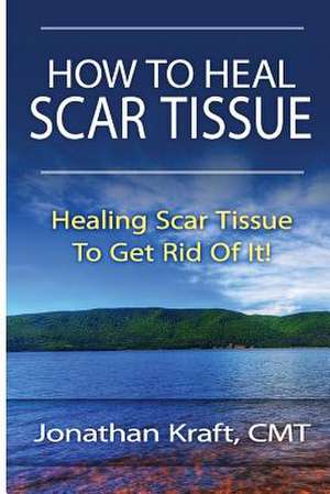 How to Heal Scar Tissue de Jonathan a. Kraft