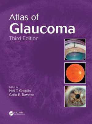 Atlas of Glaucoma de Neil T. Choplin