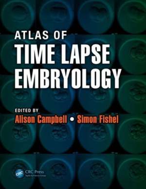 Atlas of Time Lapse Embryology de Alison Campbell