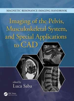 Imaging of the Pelvis, Musculoskeletal System, and Special Applications to CAD de Luca Saba