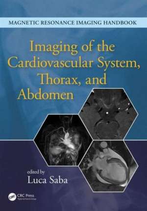 Imaging of the Cardiovascular System, Thorax, and Abdomen de Luca Saba