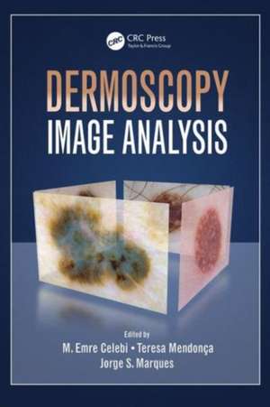 Dermoscopy Image Analysis de M. Emre Celebi