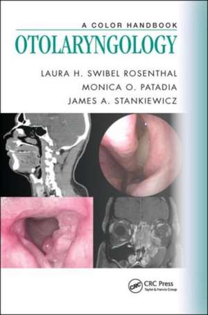 Otolaryngology: A Color Handbook de Laura H. Swibel Rosenthal