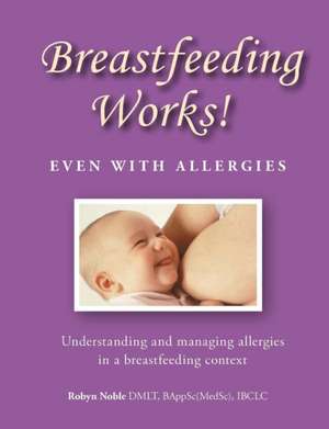 Breastfeeding Works! Even With Allergies de Robyn Noble