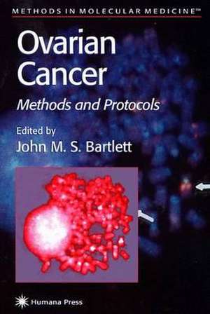 Ovarian Cancer: Methods and Protocols de John M. S. Bartlett