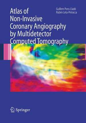 Atlas of Non-Invasive Coronary Angiography by Multidetector Computed Tomography de Guillem Pons-Llado