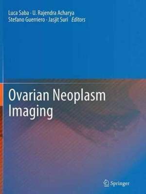 Ovarian Neoplasm Imaging de Luca Saba