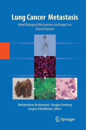 Lung Cancer Metastasis: Novel Biological Mechanisms and Impact on Clinical Practice de Venkateshwar Keshamouni