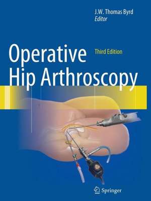 Operative Hip Arthroscopy de J.W. Thomas Byrd