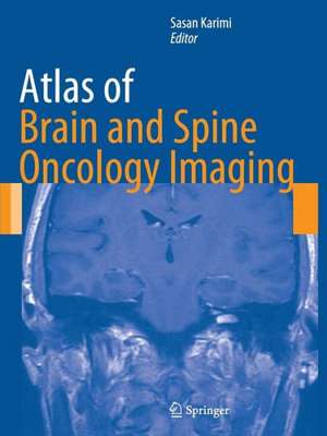 Atlas of Brain and Spine Oncology Imaging de Sasan Karimi