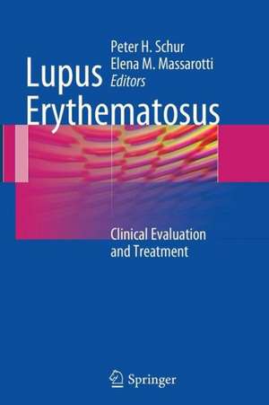 Lupus Erythematosus: Clinical Evaluation and Treatment de Peter H. Schur