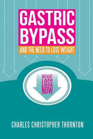 Gastric Bypass and the Need to Lose Weight de Charles Christopher Thornton