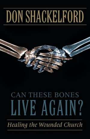 Can These Bones Live Again? de Don Shackelford