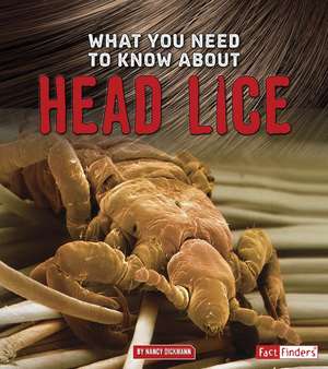 What You Need to Know about Head Lice de Nancy Dickmann